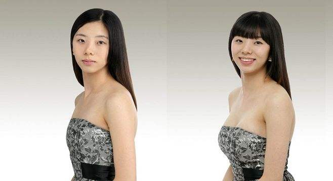胸部整形多少錢？
